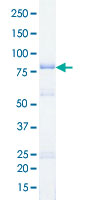 Loading 1 &mu;g protein in SDS-PAGE